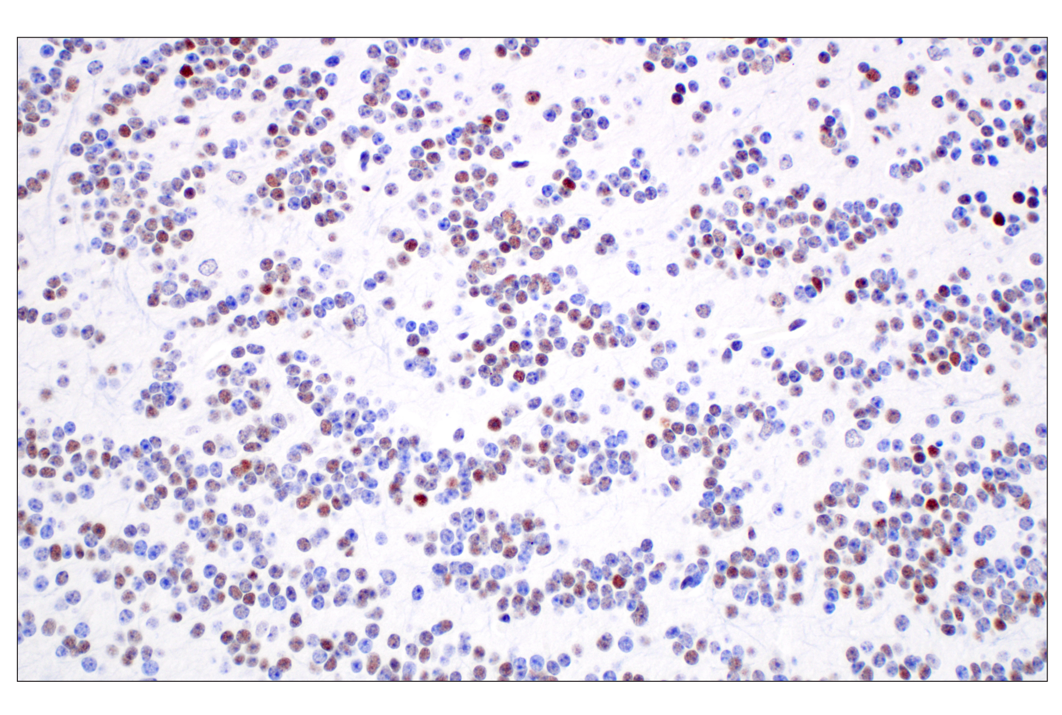 Immunohistochemistry Image 6: TCF4/ITF2 (E3X2Y) Rabbit mAb
