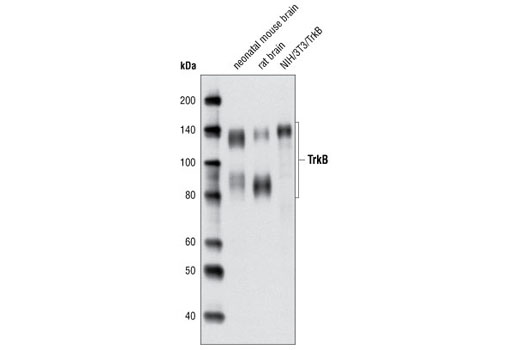  Image 3: TrkA and TrkB Antibody Sampler Kit