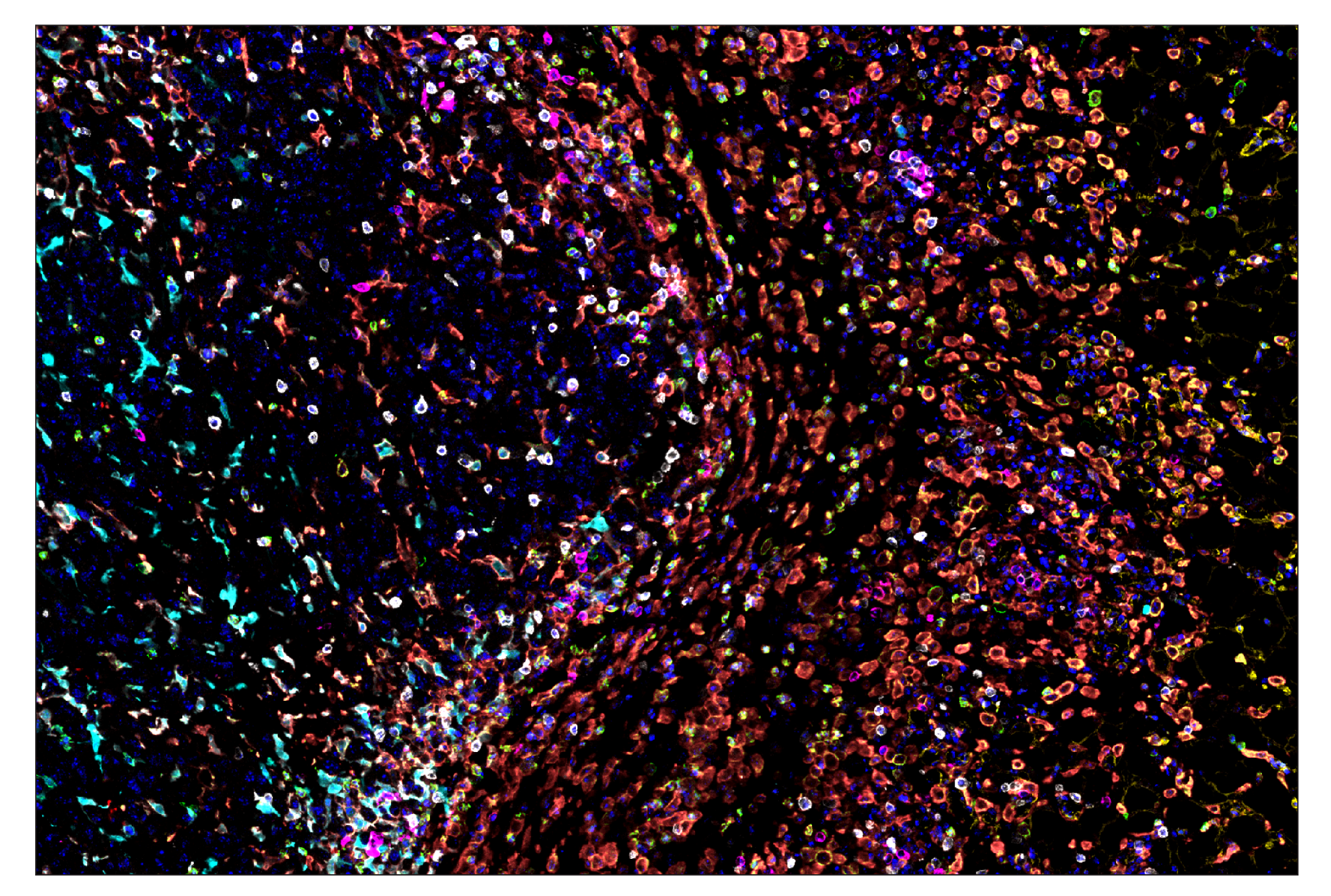 Immunohistochemistry Image 7: IL-2Rα/CD25 (E9W2J) & CO-0074-750 SignalStar™ Oligo-Antibody Pair