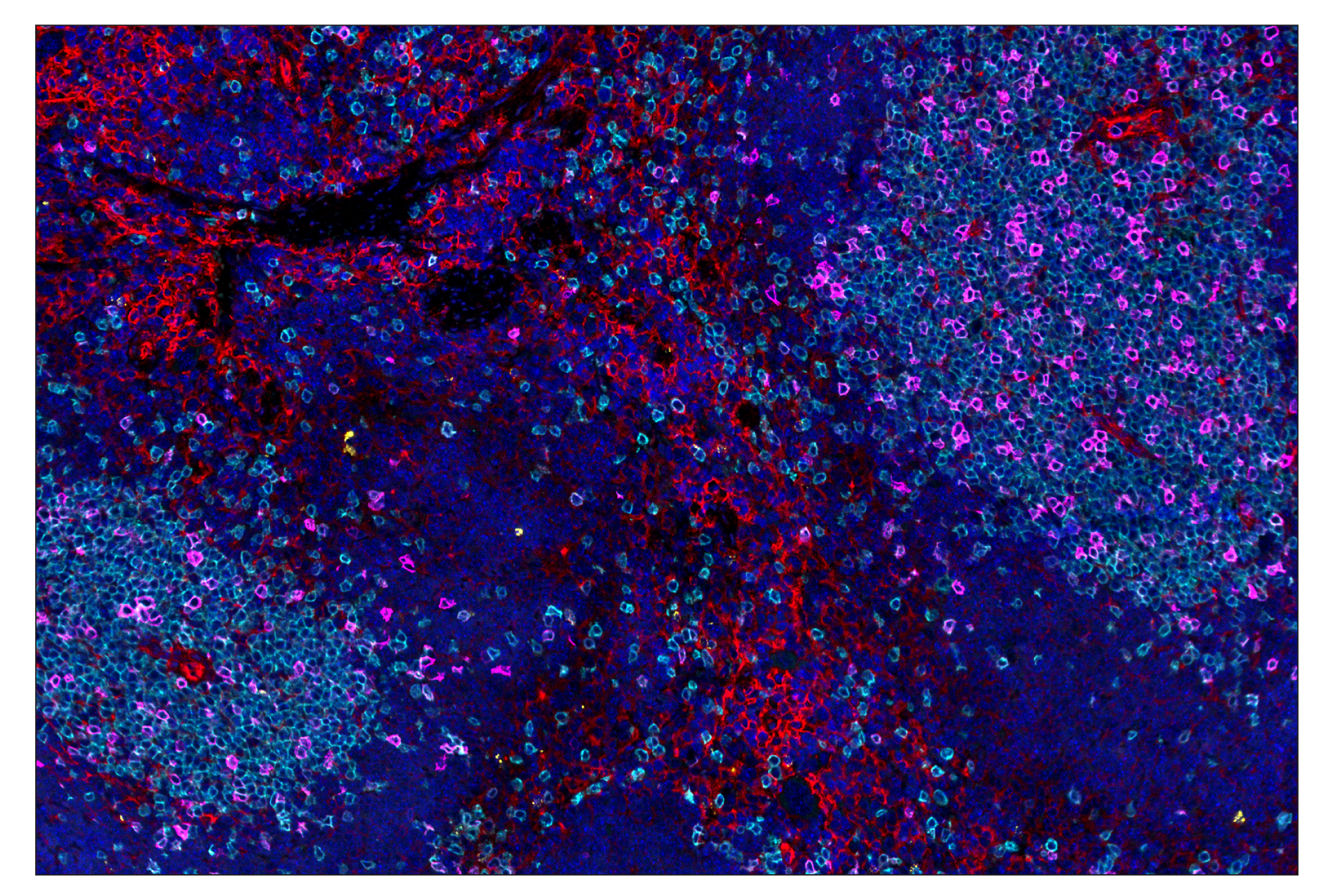 Immunohistochemistry Image 8: IL-2Rα/CD25 (E9W2J) & CO-0074-647 SignalStar™ Oligo-Antibody Pair