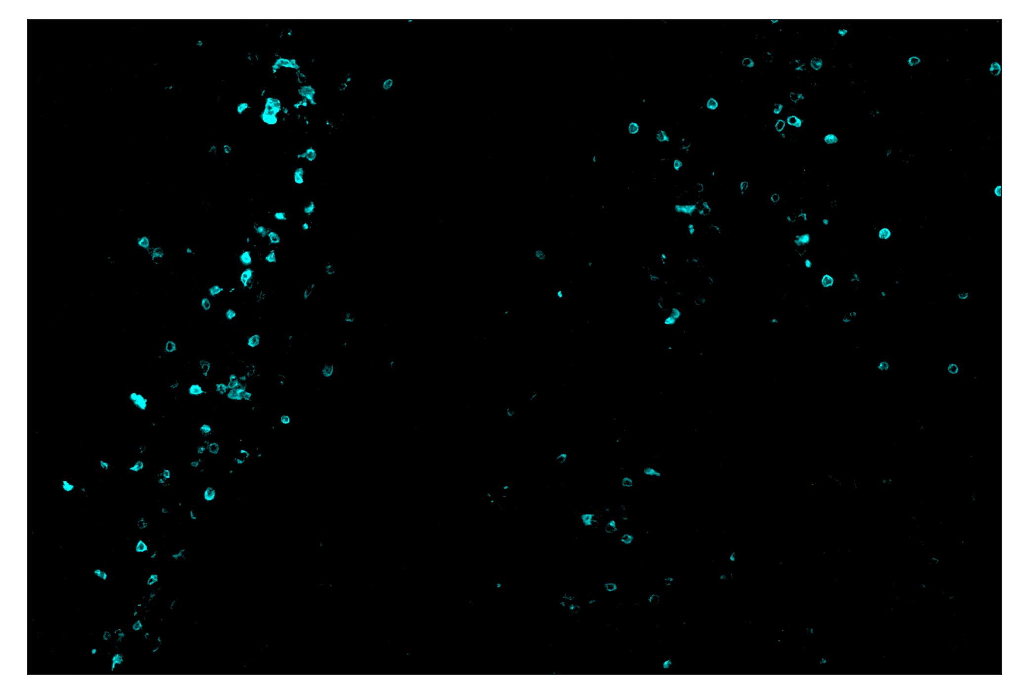 Immunohistochemistry Image 5: IL-2Rα/CD25 (E9W2J) & CO-0074-750 SignalStar™ Oligo-Antibody Pair