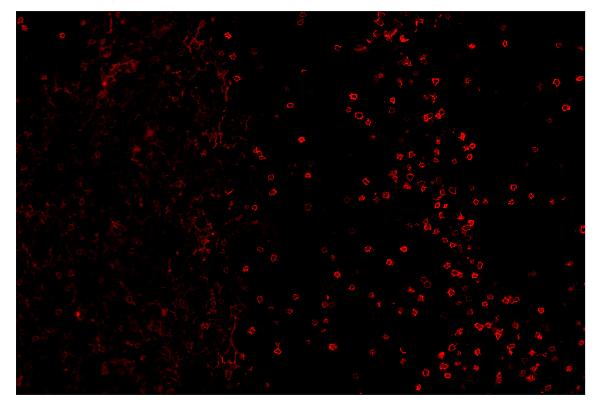 Immunohistochemistry Image 4: IL-2Rα/CD25 (E9W2J) & CO-0074-647 SignalStar™ Oligo-Antibody Pair