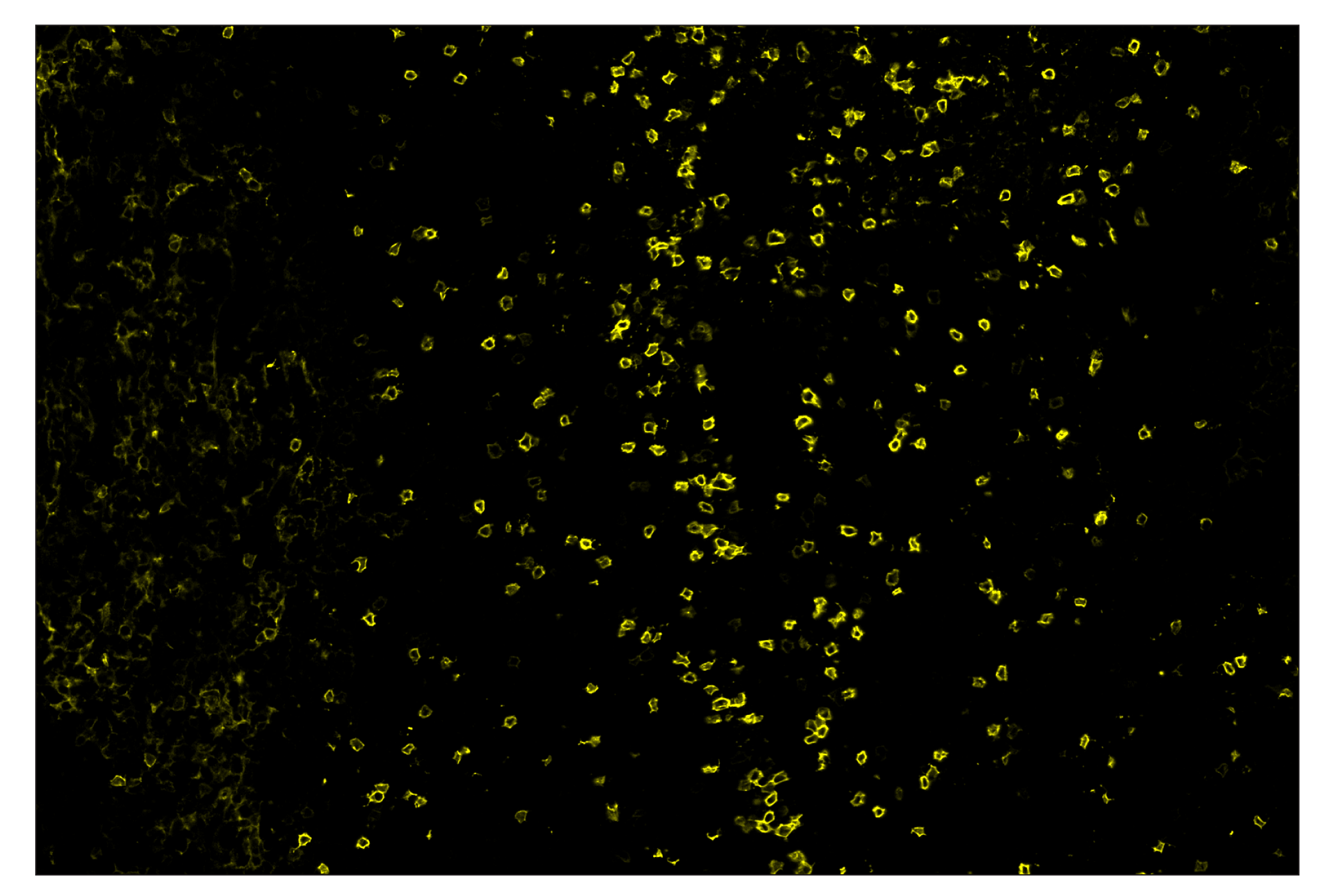 Immunohistochemistry Image 3: IL-2Rα/CD25 (E9W2J) & CO-0074-647 SignalStar™ Oligo-Antibody Pair