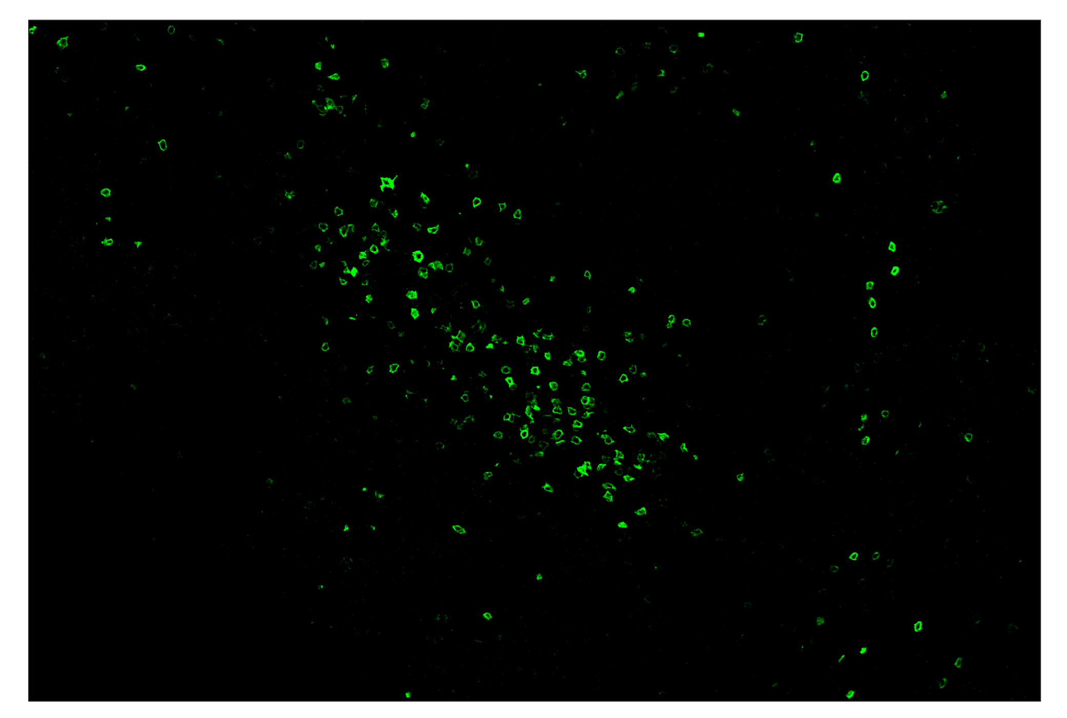 Immunohistochemistry Image 2: IL-2Rα/CD25 (E9W2J) & CO-0074-750 SignalStar™ Oligo-Antibody Pair