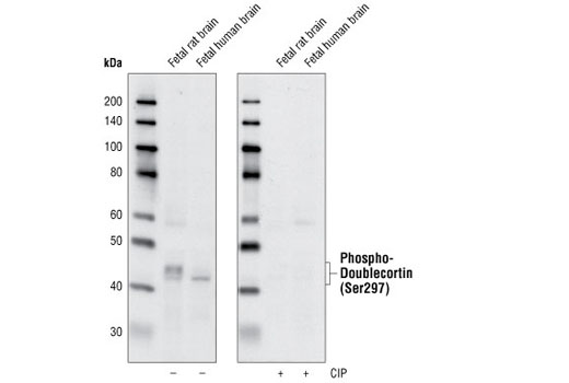 Western Blotting Image 1: Phospho-Doublecortin (Ser297) Antibody