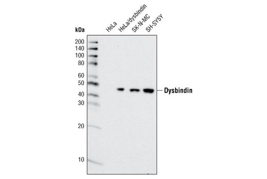 Western Blotting Image 1: Dysbindin Antibody