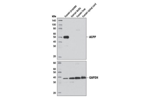 Western Blotting Image 1: Prostatic Acid Phosphatase (D3Y5P) Rabbit mAb (BSA and Azide Free)
