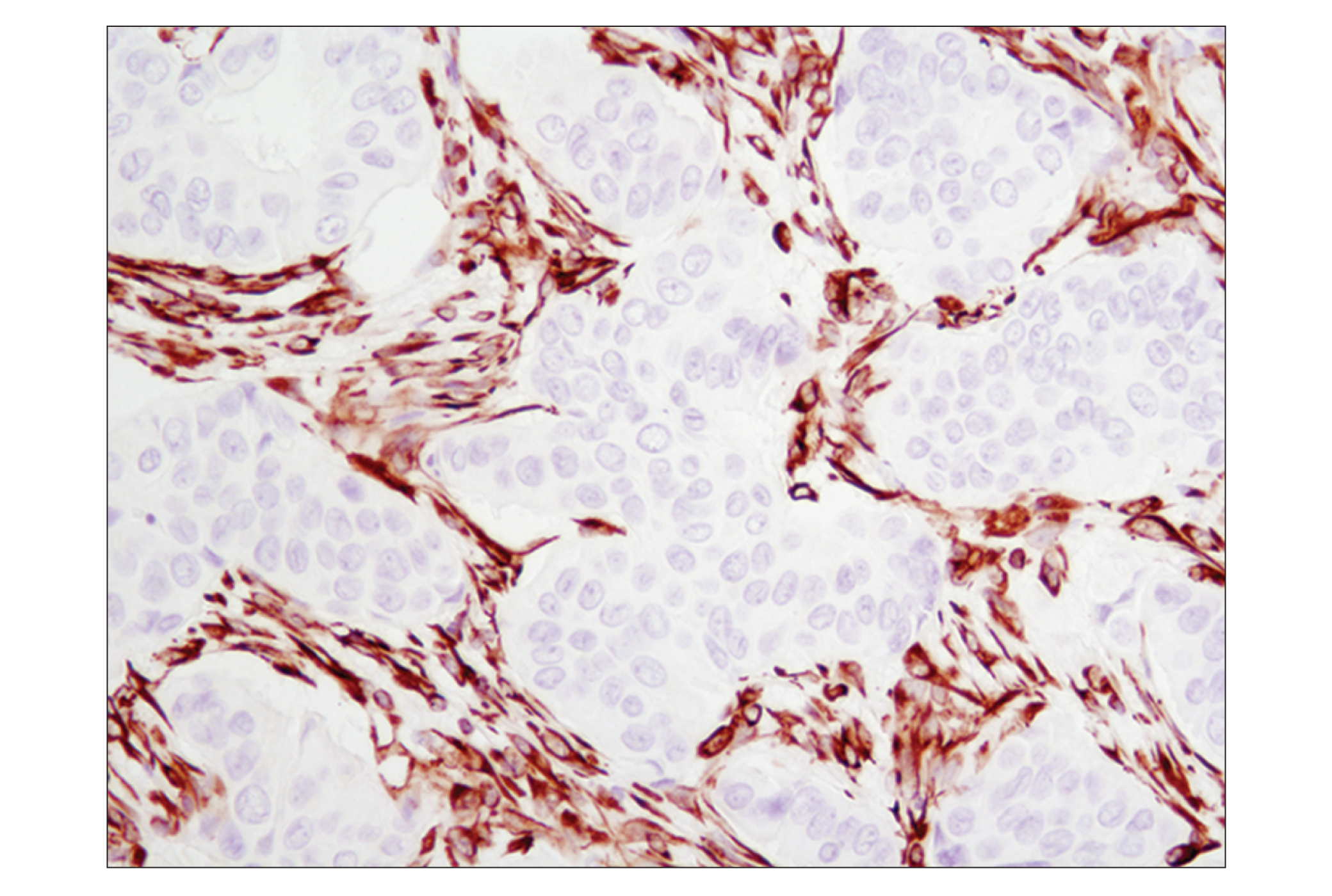 Immunohistochemistry Image 3: Vimentin (D21H3) XP® Rabbit mAb (BSA and Azide Free)