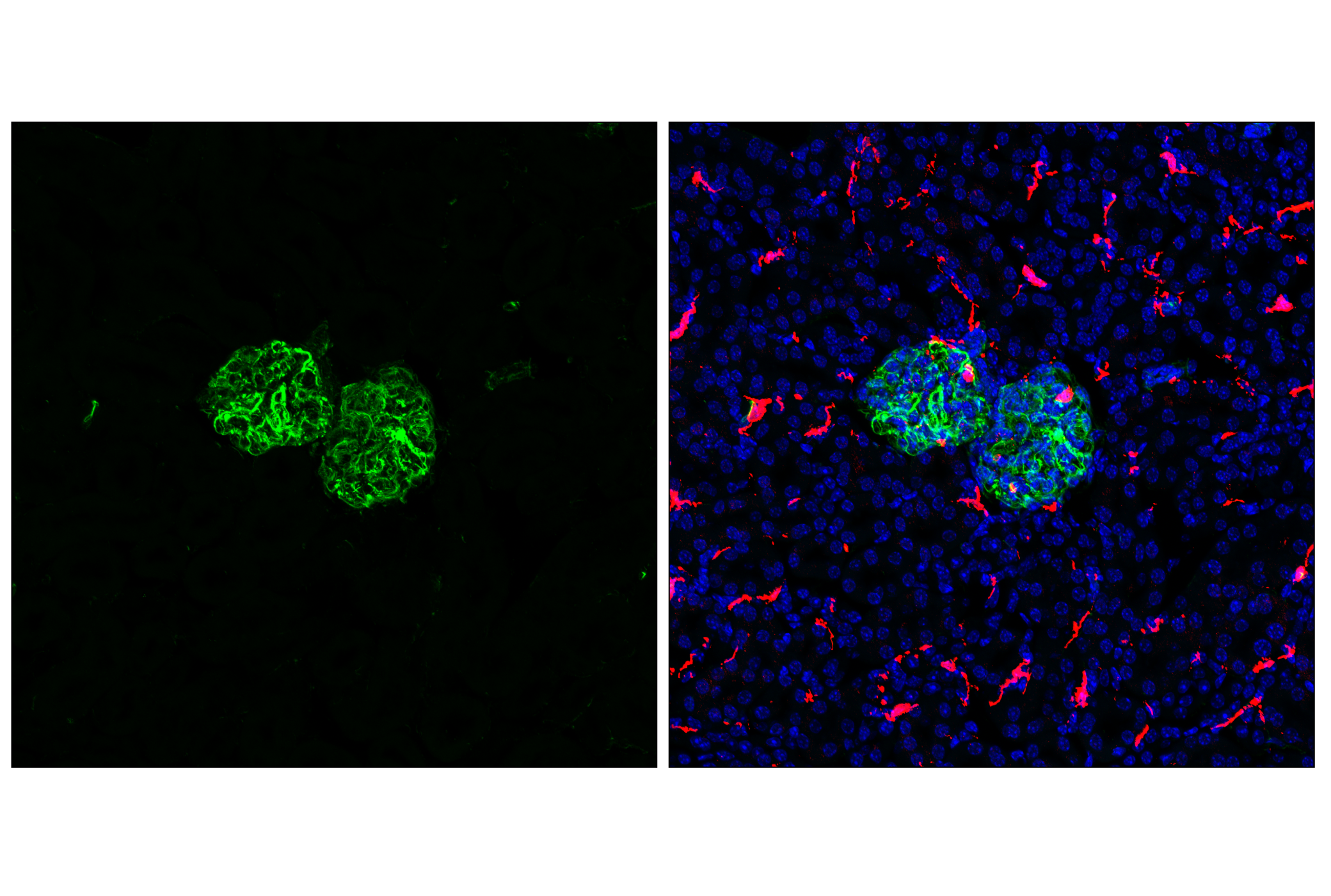 Immunofluorescence Image 1: Vimentin (D21H3) XP® Rabbit mAb (BSA and Azide Free)