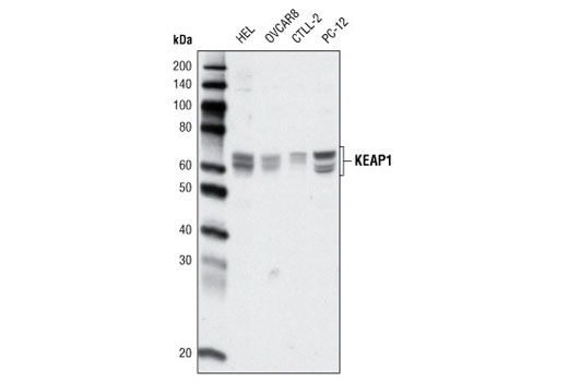 Western Blotting Image 1: KEAP1 (H436) Antibody