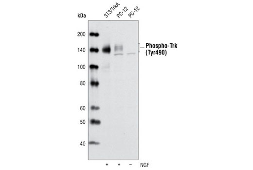  Image 4: PhosphoPlus® TrkA (Tyr490)/TrkB (Tyr516) Antibody Duet