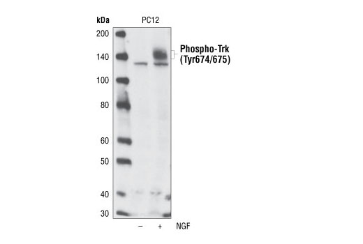  Image 11: TrkA and TrkB Antibody Sampler Kit