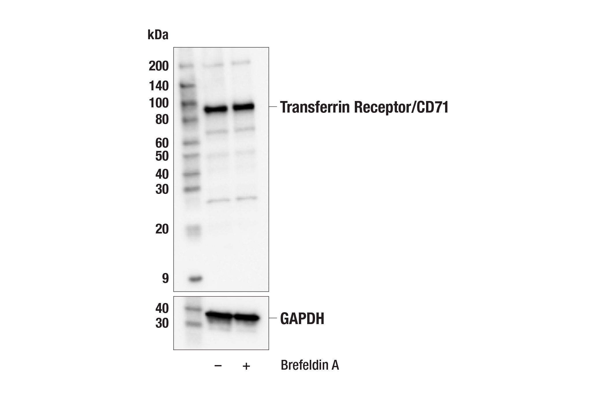 Western Blotting Image 1: Transferrin Receptor/CD71 (H68.4) Mouse mAb