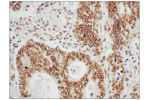 Immunohistochemistry Image 1: Exportin-1/CRM1 (D6V7N) Rabbit mAb