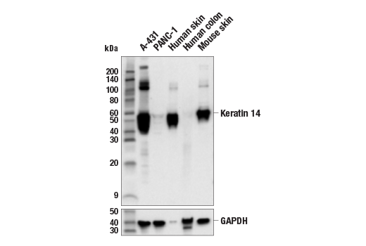 Western Blotting Image 1: Keratin 14 Antibody