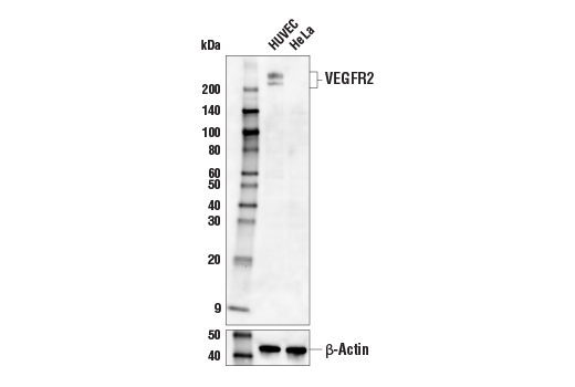 Western Blotting Image 1: VEGF Receptor 2 (55B11) Rabbit mAb (Biotinylated)