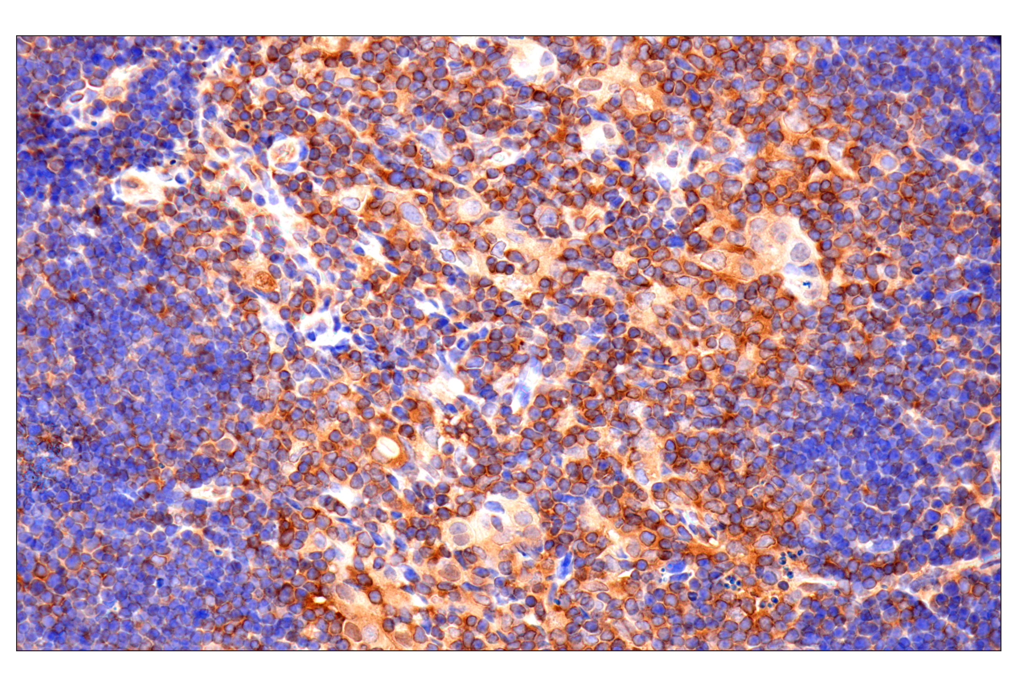 Immunohistochemistry Image 8: Caspase-8 (F5K9P) Rabbit mAb (BSA and Azide Free)