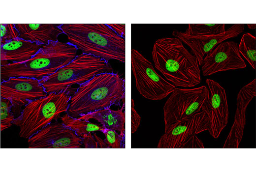 Immunofluorescence Image 1: β-Catenin (L54E2) Mouse mAb (Alexa Fluor® 647 Conjugate)