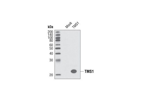 Western Blotting Image 1: TMS1 Antibody