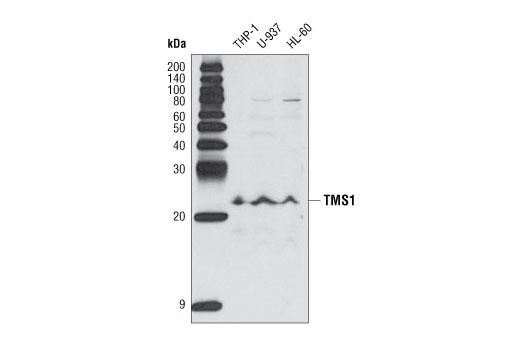 Western Blotting Image 2: TMS1 Antibody