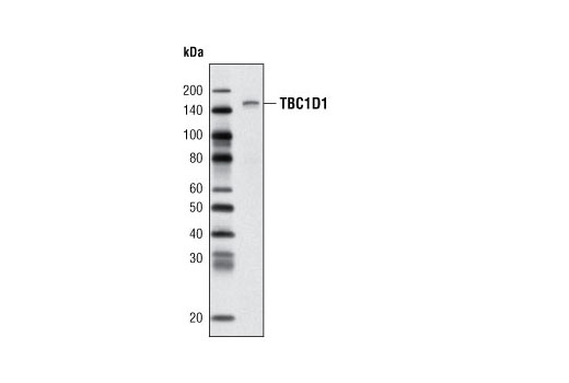 Western Blotting Image 1: TBC1D1 (V796) Antibody
