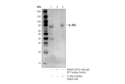 Immunoprecipitation Image 1: IL-2Rβ (D4X3H) Rabbit mAb