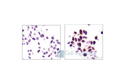 Immunohistochemistry Image 5: Phospho-p38 MAPK (Thr180/Tyr182) (12F8) Rabbit mAb