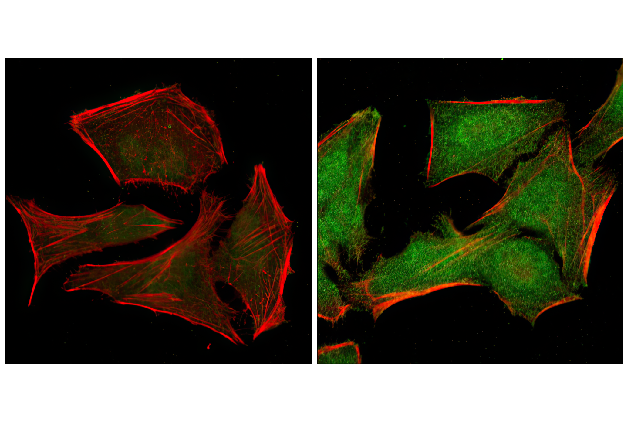 Immunofluorescence Image 1: Phospho-p38 MAPK (Thr180/Tyr182) (12F8) Rabbit mAb