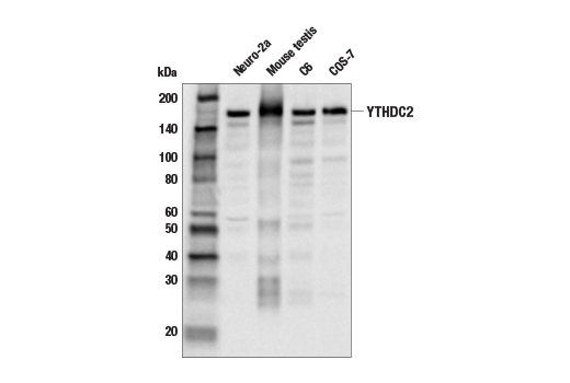 Image 18: N6-Methyladenosine (m6A) Binding Protein Antibody Sampler Kit