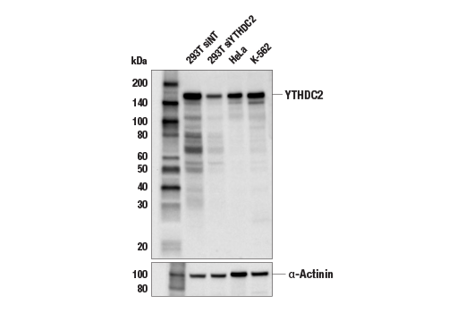 Image 4: N6-Methyladenosine (m6A) Binding Protein Antibody Sampler Kit