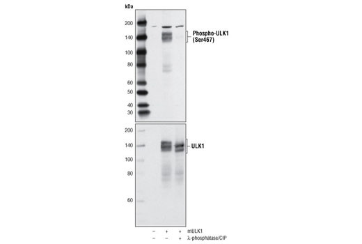 Western Blotting Image 1: Phospho-ULK1 (Ser467) Antibody