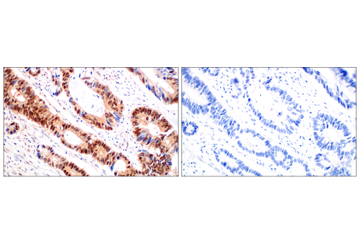 Immunohistochemistry Image 13: CRBN (D8H3S) Rabbit mAb (BSA and Azide Free)