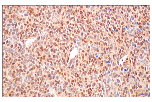 Immunohistochemistry Image 10: CRBN (D8H3S) Rabbit mAb (BSA and Azide Free)
