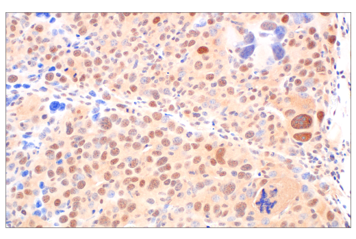 Immunohistochemistry Image 11: CRBN (D8H3S) Rabbit mAb (BSA and Azide Free)