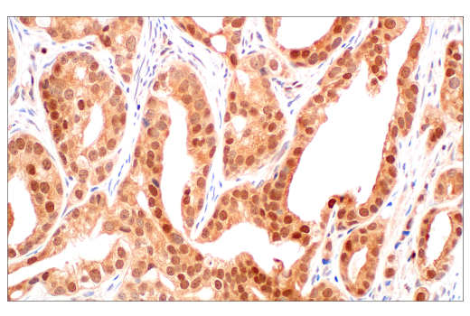 Immunohistochemistry Image 2: CRBN (D8H3S) Rabbit mAb (BSA and Azide Free)