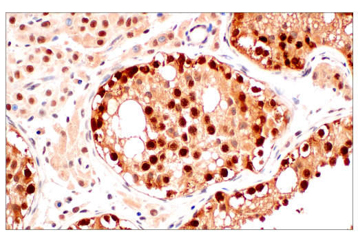 Immunohistochemistry Image 8: CRBN (D8H3S) Rabbit mAb (BSA and Azide Free)