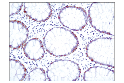 Immunohistochemistry Image 2: EpCAM (VU1D9) Mouse mAb (BSA and Azide Free)