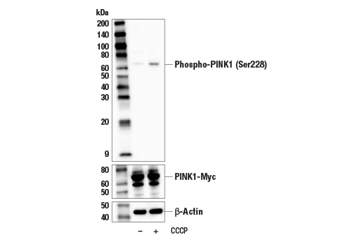 Western Blotting Image 1: Phospho-PINK1 (Ser228) Antibody