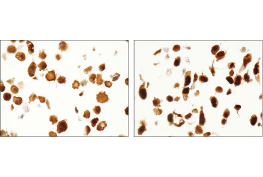 Immunohistochemistry Image 3: HSP70 (D1M6J) Mouse mAb