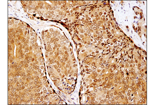 Immunohistochemistry Image 4: HSP70 (D1M6J) Mouse mAb