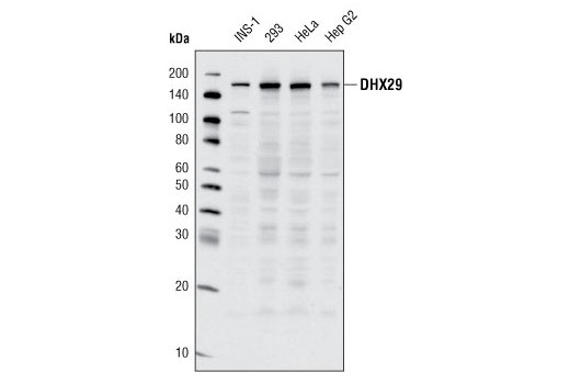 Western Blotting Image 1: DHX29 (G63) Antibody