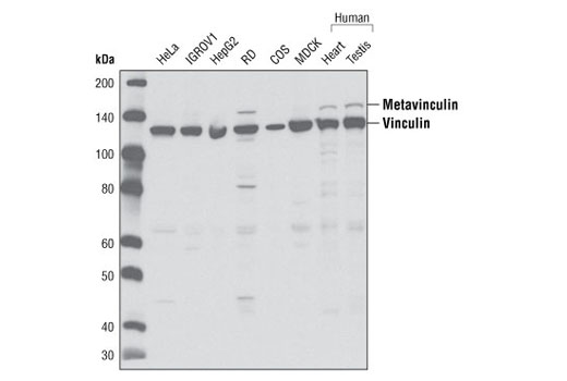 Western Blotting Image 1: Vinculin Antibody