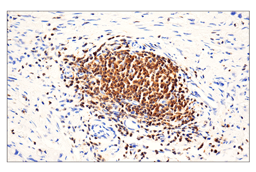 Immunohistochemistry Image 2: HPK1 (E1C3L) Rabbit mAb