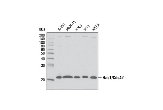 Western Blotting Image 1: Rac1/Cdc42 Antibody