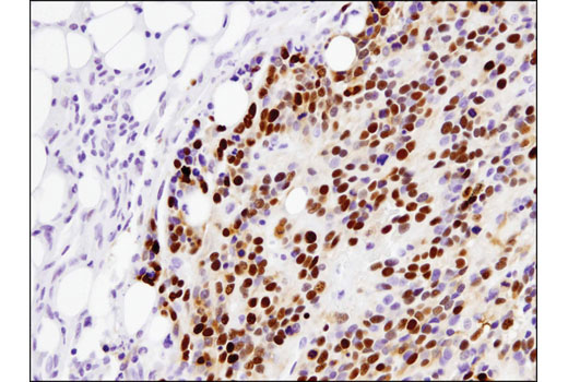 Immunohistochemistry Image 2: p53 (DO-7) Mouse mAb (BSA and Azide Free)