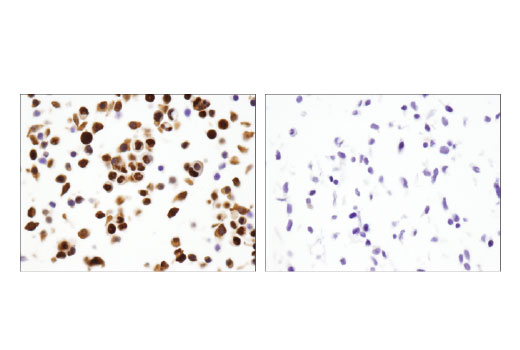 Immunohistochemistry Image 4: p53 (DO-7) Mouse mAb (BSA and Azide Free)