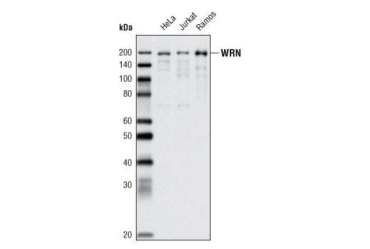 Western Blotting Image 1: WRN (8H3) Mouse mAb
