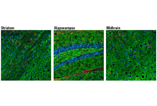  Image 45: Tau Mouse Model Neuronal Viability IF Antibody Sampler Kit