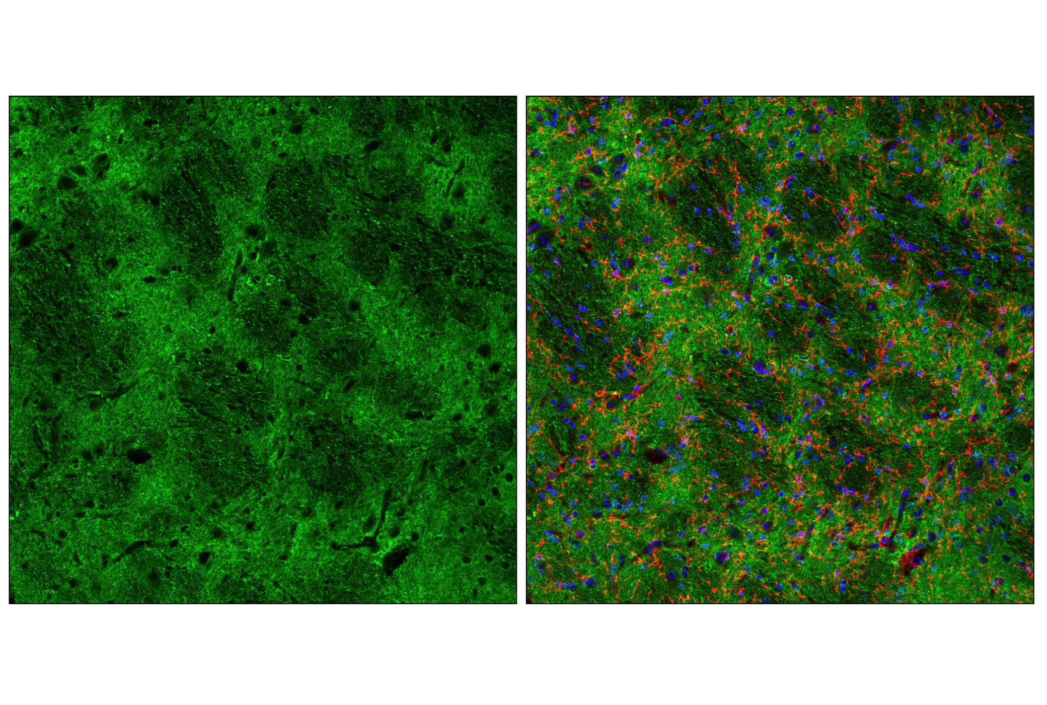 Immunofluorescence Image 3: Tau (D1M9X) XP® Rabbit mAb