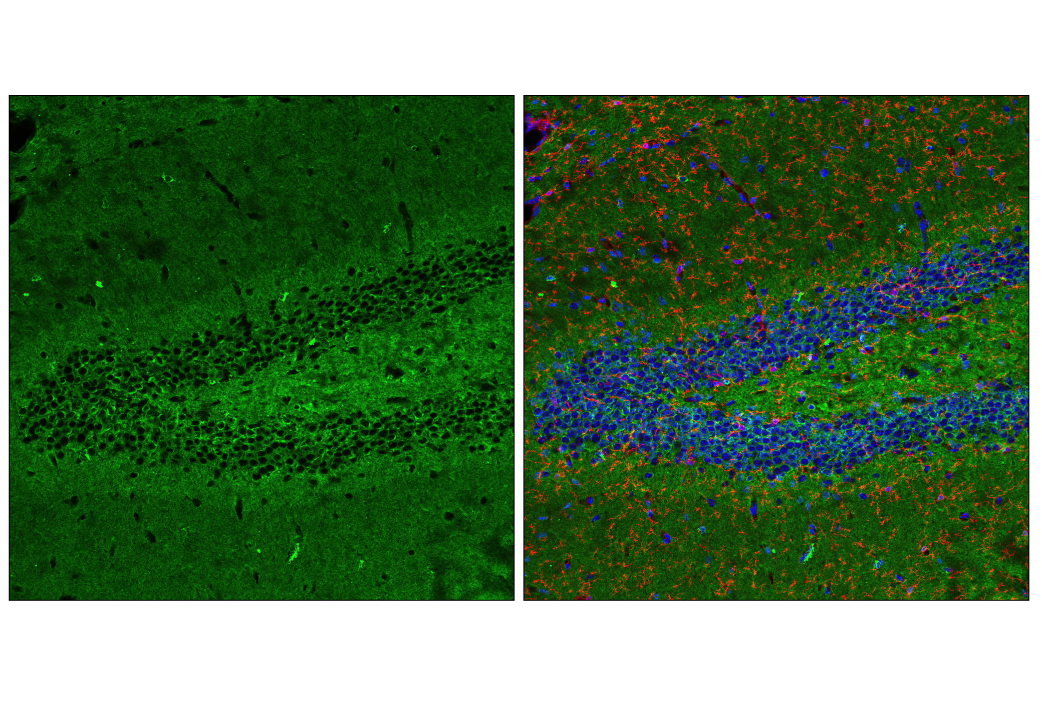 Immunofluorescence Image 2: Tau (D1M9X) XP® Rabbit mAb